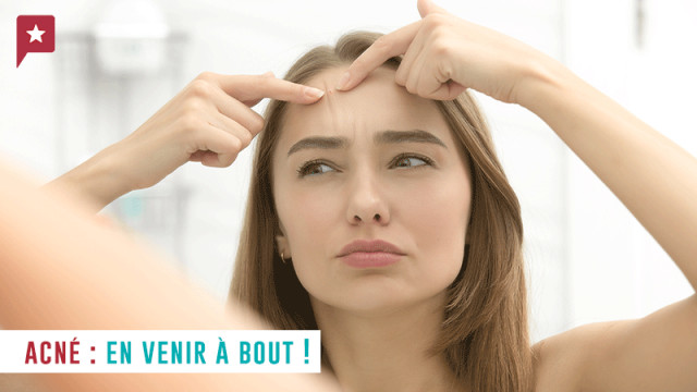 Acné : quelques conseils pour en venir à bout